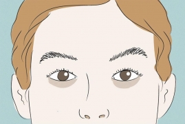 黑眼圈是怎么引起的，长期晚睡睡够也会有黑眼圈原因